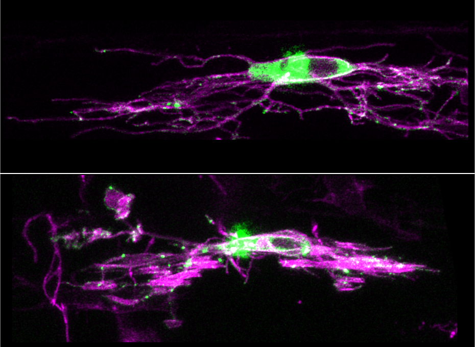 Study reveals function of little-understood synapse in the brain